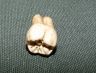 2ème molaire gauche (Homo neanderthalensis)